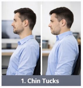 Tech Neck Exercises