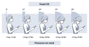 posture-related